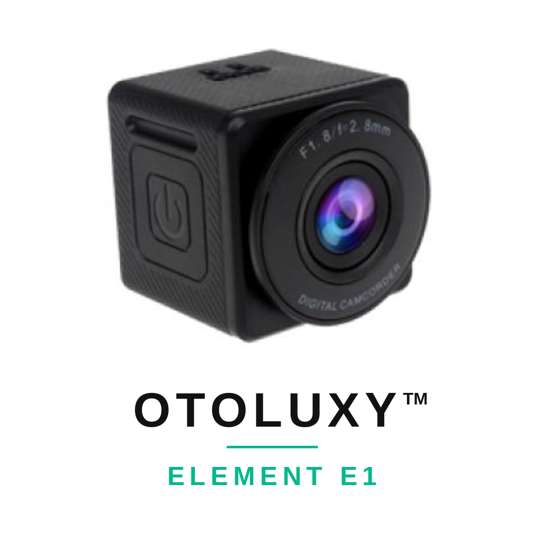 Otoluxy™ Élément E1 – Mini Dashcam 2K WiFi avec Mode Parking 24h